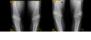 fruitos coomparativa